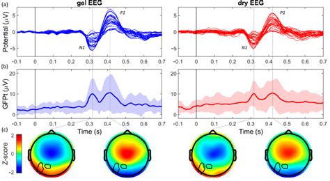 Auditory Evoked Potential Vep Evoked By The Auditory Steady State