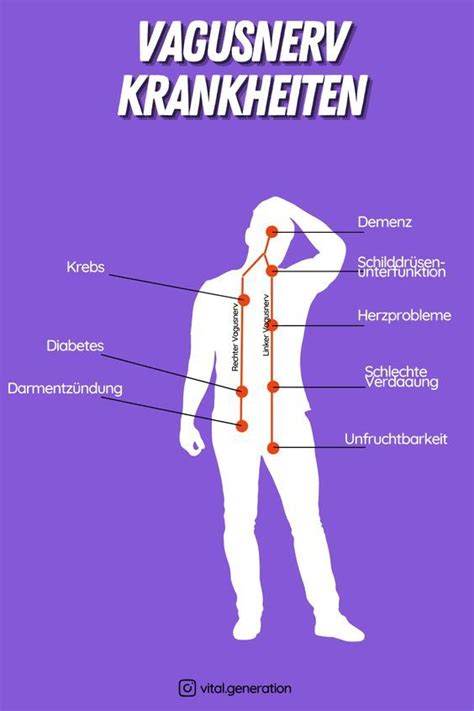 Unter Hoher Belastung Von Stress Kann Es Sein Dass Neuronen Des