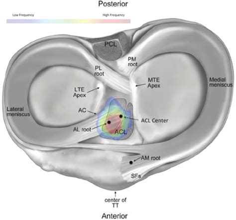 6 Meniscus Tear Types That You Need To Know About