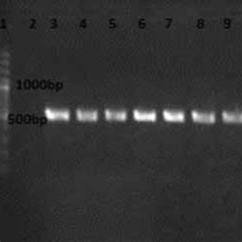 Gel Image Of Representative Pcr Of Mexr Gene Line Ladder Lane