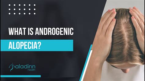 What Is Androgenic Alopecia Youtube