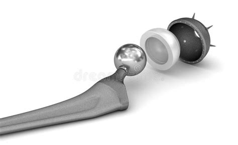 Hip Replacement Implant Isolated On White Stock Illustration