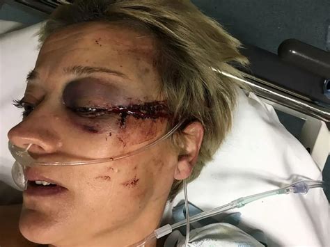 Mum Paralysed In Freak Riding Accident Still Wants Sex Despite Having No Feeling In Sexual