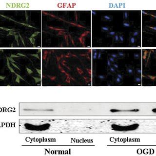 A Immunofluorescent Double Labeling Staining Of Ndrg And Gfap Showed