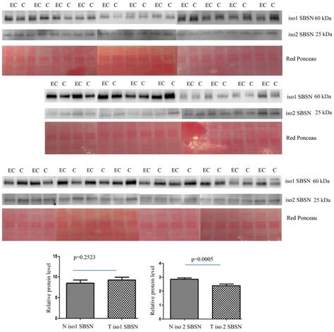 IJMS Free Full Text Gel Based Proteomic Identification Of