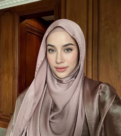 Kronologi Anak Selebgram Emy Aghnia Diduga Dianiaya Pengasuh