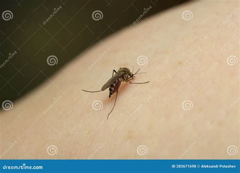 A Mosquito Sits On The Woman S Hand And Sucks Blood Pain Danger Of