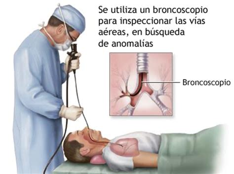 Broncoscopía Cátedra de Neumología