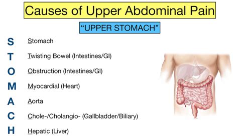 Abdominal Pain Causes: The Upper Stomach Trick and Examples — EZmed