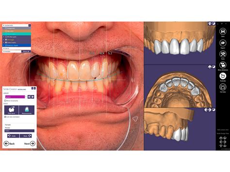 Exocad Smile Creator Module Gold Quadrat Dental