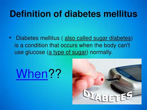 Ppt Diabetes Mellitus Powerpoint Presentation Free Download Id1904737