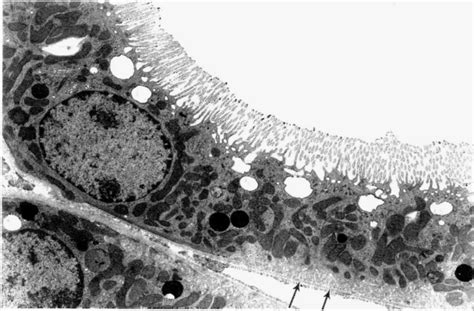 Transmission Electron Micrograph Of An S2 Segment Of The Proximal