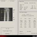 Densitométrie osseuse du corps entier DXA absorptiométrie