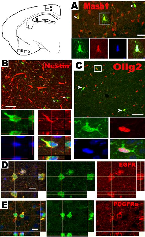 Phenotypic features of plp promoter expressing progenitors (PPEPs). Plp ...