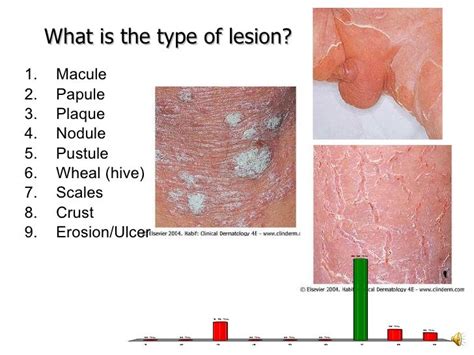 Pathology Of Skin Introduction