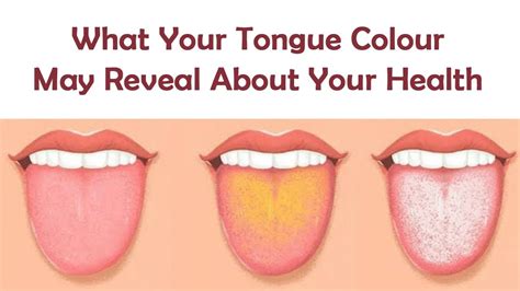 Healthy Tongue Colour