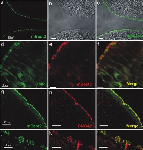 Localization Of Mbest On The Sensory Cilia Of Osns A And C Oe