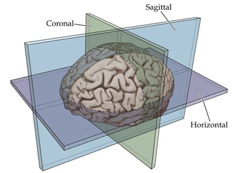 Brain Anatomy And Mri Flashcards Quizlet