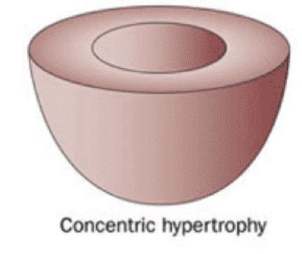 Pathologie Du Syst Me Cardiovasculaire Anomalies Cong Nitales