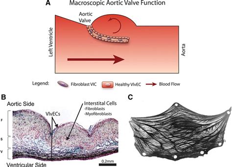 Hemodynamic And Cellular Response Feedback In Calcific Aortic Valve