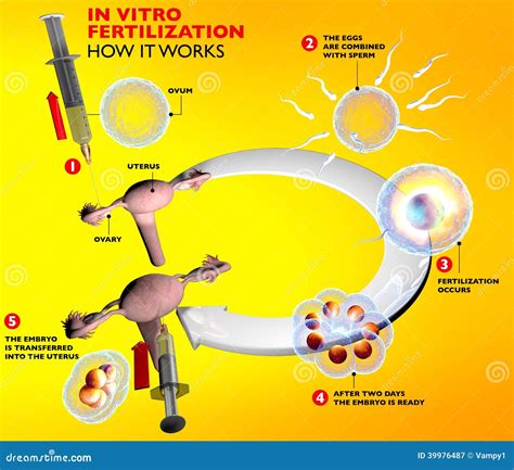 In Vitro Fertilization Artificial Insemination Route Stock