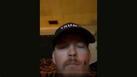 Joshua Black, Alabama man shot in face while storming US Capitol