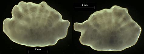 Figure E3 Left And Right Otolith From Fish Id 5678 Female 59 Cm At