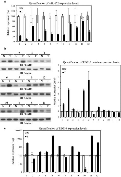 R 122 And Peg10 Expression Levels In Hcc Tissue A Mir 122 Expression