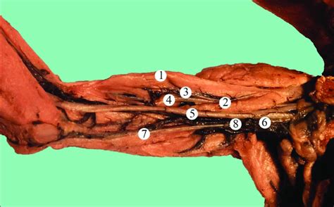 Structures Of The Right Anterior Brachial Region Of A Fetus Of 170 0 Mm