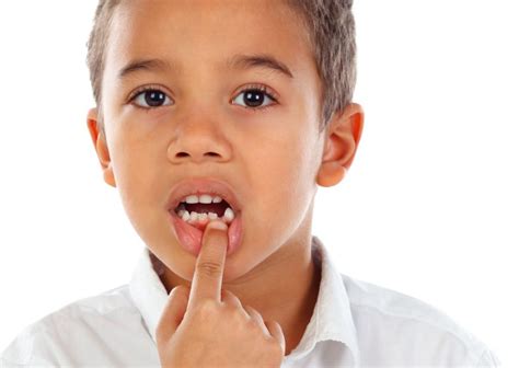 A qué edad se caen los dientes de leche Clínica Dental Everest