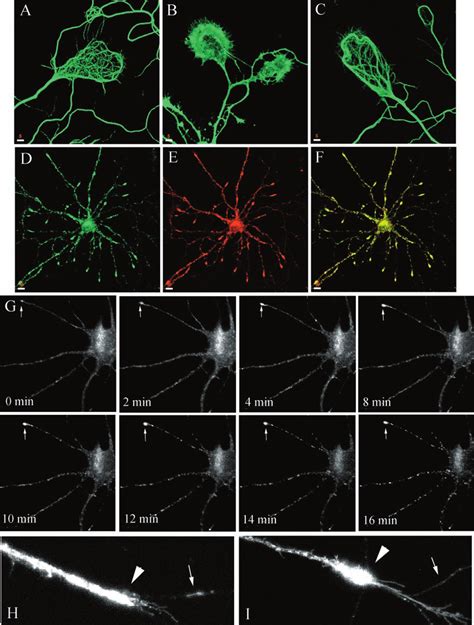 Nocodazole Effect On Localization And Dynamics Of Syntaxin