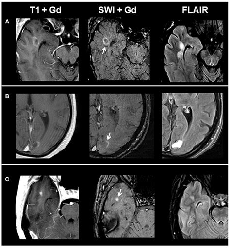 Frontiers Characterization Of Contrast Enhancing And Non Contrast