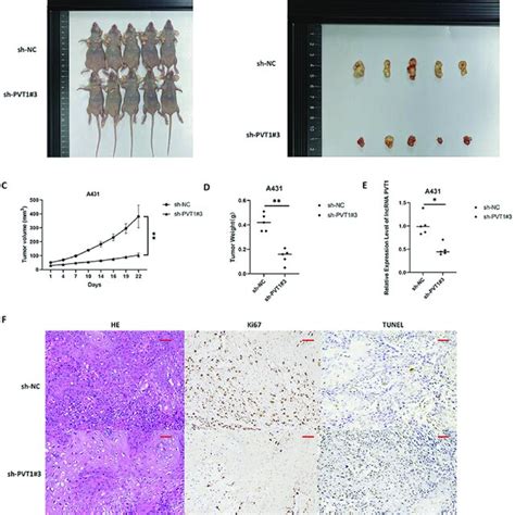 The Lncrna Pvt1 Knockdown Inhibits Xenograft Tumor Growth And Enhances