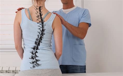 How Chiropractic Helps Scoliosis Chiropractor Roseville