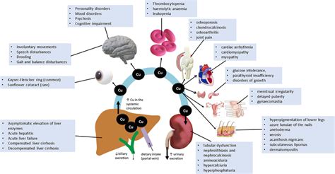 Wilson Disease Abstract Europe Pmc