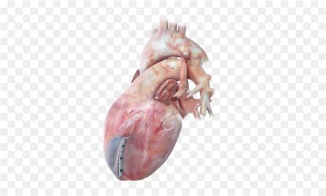 Heart Scar Tissue Hd Png Download Vhv