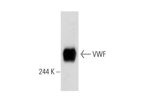 Von Willebrand Factor Vwf Antibody G Scbt Santa Cruz Biotechnology