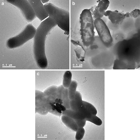 TEM photographs of a denitrifying bacteria, b denitrifying bacteria ...