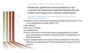 Thyroid Ablation.pptx