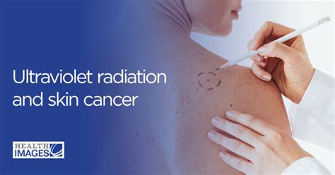 Ultraviolet Radiation And Skin Cancer Envision Radiology