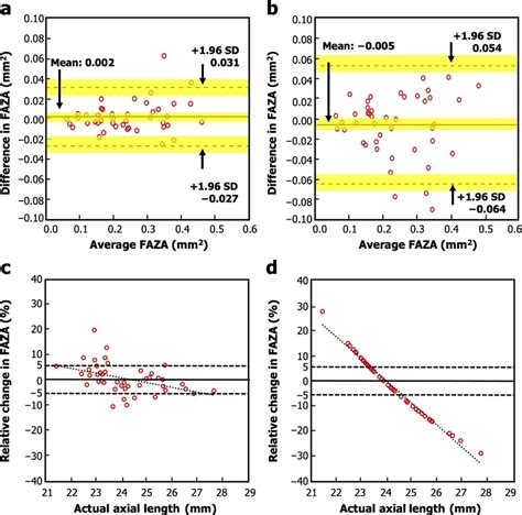 Bland Altman Plots Illustrating The Agreement Between A FAZA