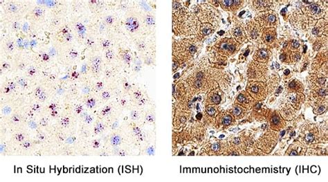 Anti Vegf165 Antibody Af 293 Na Randd Systems