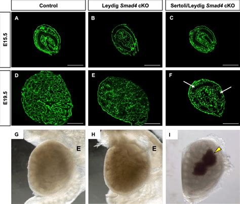 Testis Morphogenesis In Control And Smad Conditional Knockout Mouse