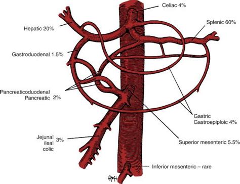 Direct Surgical Repair Of Visceral Artery Aneurysms Clinical Tree