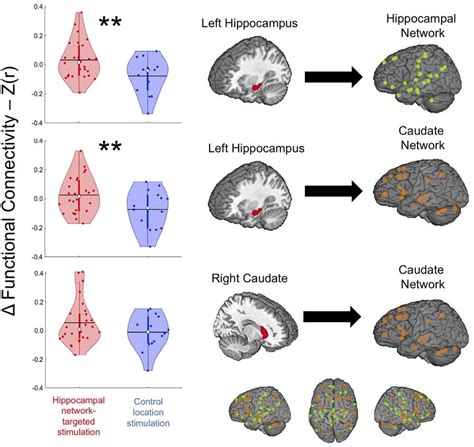 Violin Plots Of Left Hippocampal And Right Caudate Functional Download Scientific Diagram