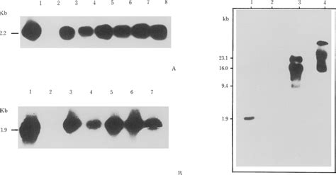 Southern Blot Hybridization Of Dna Isolated From Groundnut Transgenic