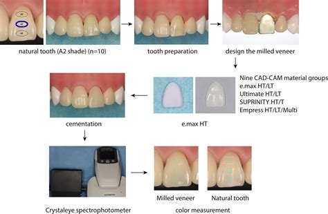 Effect Of Cad Cam Ceramic Materials On The Color Match Of Veneer