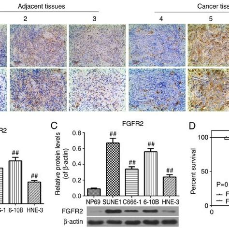 Cell Viability And Expression Of FGFR2 Following Cisplatin Treatment At