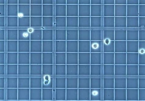 Using Trypan Blue to Check Cell Viability - Allevi