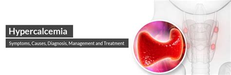 Hypercalcemia Symptoms Causes Diagnosis Management And Treatment